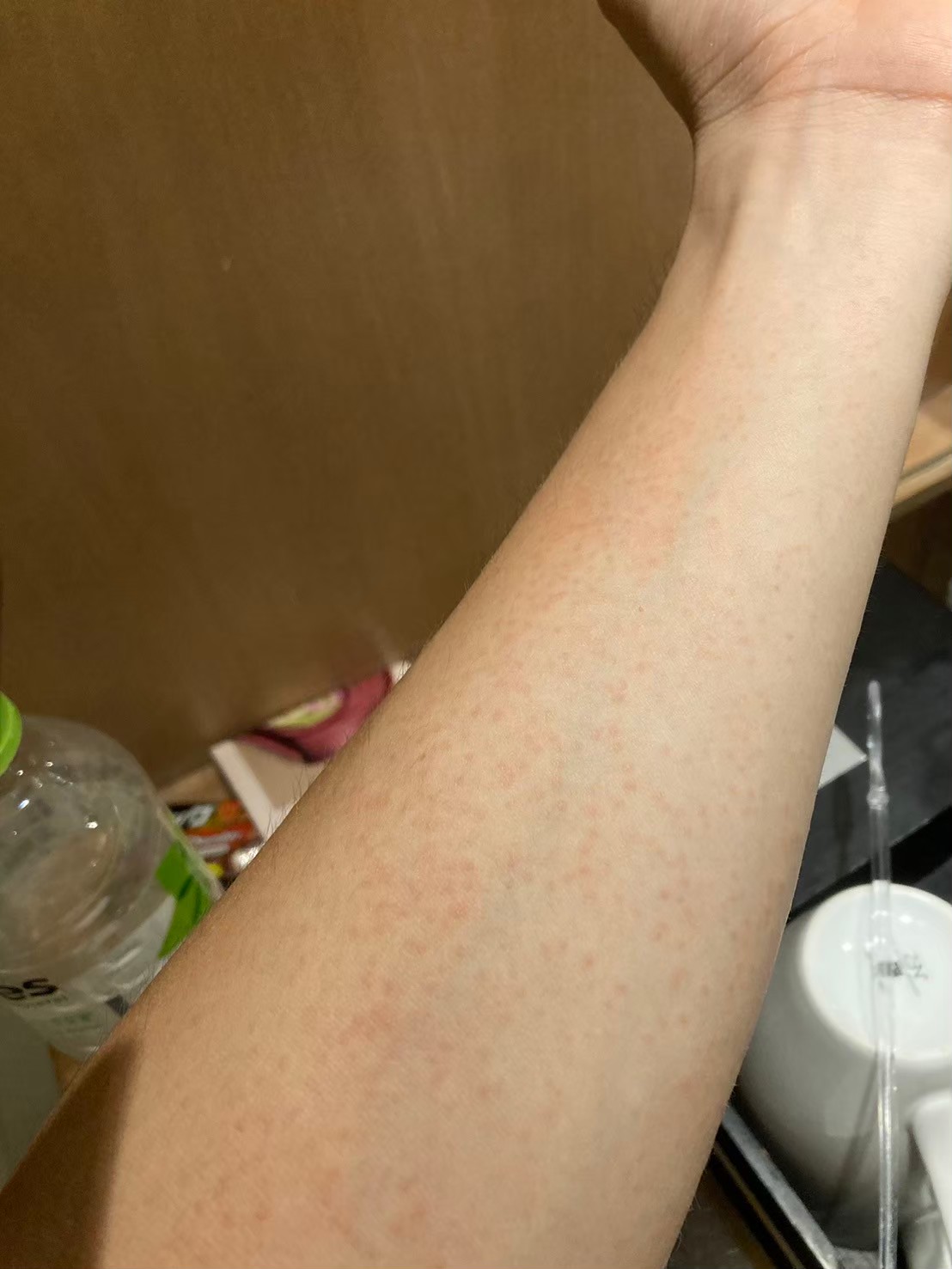 紅疹 https://dtks6emtee9cj.cloudfront.net/20240523/3042.jpg